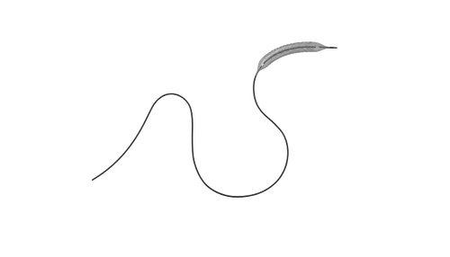 Hybrid NeoHexa - Drug Eluting Coronary Stent - SLTL Medical